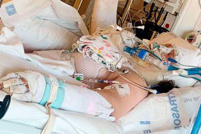 Девочка попыталась повторить тренд из TikTok, подожгла дом и попала в больницу - lenta.ru - USA - штат Орегон