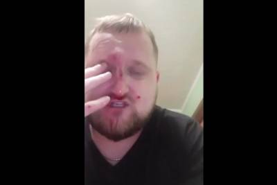 Андрей Афанасьев - В Благовещенске избили арматурой журналиста, готовившего материалы о клубе «Ахмат» - mk.ru - Благовещенск