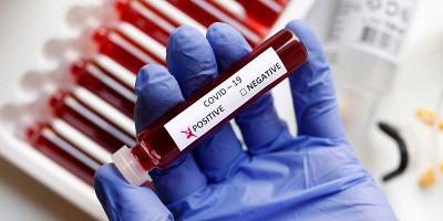Тим Спектор - Ученые предупредили об изменении основных симптомов коронавируса - newzfeed.ru - Англия - Лондон