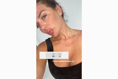 Анна Седокова - Бывшая солистка «ВИА Гры» показала изменившееся после болезни лицо - lenta.ru