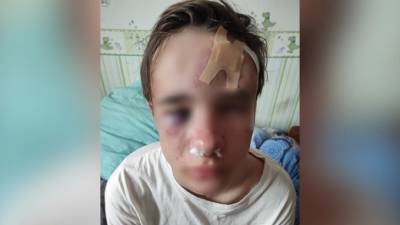 В Петербурге двое незнакомцев избили 16-летнего подростка из-за сережки в ухе - piter.tv - Санкт-Петербург