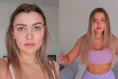 Девушка потратила сотни тысяч рублей на новую внешность ради задания в TikTok - lenta.ru - Лондон