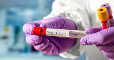 В Вооруженных силах — четыре новых случая COVID-19, двух больных госпитализировали - dsnews.ua