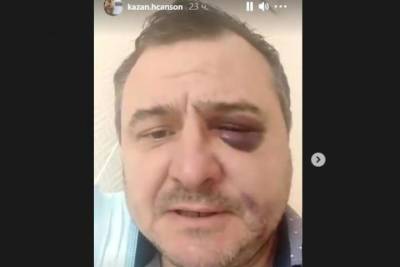 Бывшего музыканта Лесоповала избили в Сочи - kuban.mk.ru - Сочи