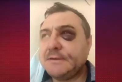 В Сочи избили бывшего солиста группы «Лесоповал» - lenta.ru - Санкт-Петербург - Сочи - Адлер