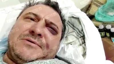 Экс-солист «Лесоповала» рассказал о своем состоянии после избиения - iz.ru - Сочи