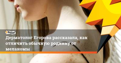 Татьяна Егорова - Дерматолог Егорова рассказала, как отличить обычную родинку от меланомы - ridus.ru