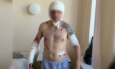 «Пытался снять скальп»: сахалинец выжил в схватке с медведем и сам доехал в больницу - bloknot.ru - Сахалинская обл. - район Анивский - Сахалин