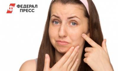 Юлия Галлямова - Дерматолог объяснила, почему нельзя избавляться от прыщей в «треугольнике смерти» - fedpress.ru - Москва
