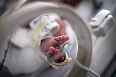 Самый недоношенный в мире ребенок отпраздновал первый день рождения - lenta.ru - Техас - USA