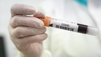 Ученые обнаружили измененные клетки крови у пациентов с COVID-19 - iz.ru