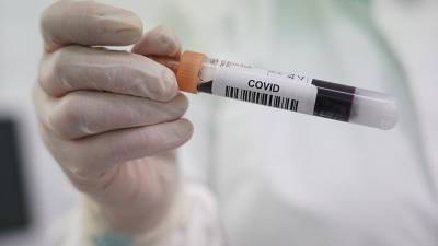 Ученые назвали людей с наибольшим количеством антител к COVID-19 - iz.ru