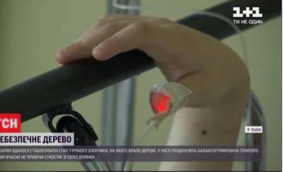Медики стабилизировали состояние мальчика, на которого упало огромное дерево во Львове - kp.ua - Львов