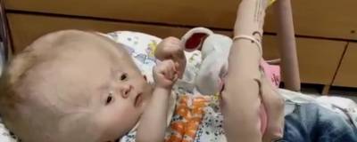 Маленькому кировчанину с гидроцефалией помог немецкий фонд - runews24.ru