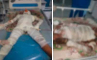 В Андижанской области 13-летний тиктокер залез на крышу поезда для съемок видео. Его ударило током, он находится в реанимации - podrobno.uz - Узбекистан - Ташкент