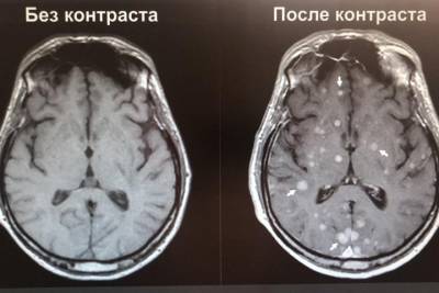 Новосибирские ученые разработали нетоксичные контрастные реагенты для МРТ-исследований - tayga.info - Россия - Новосибирск