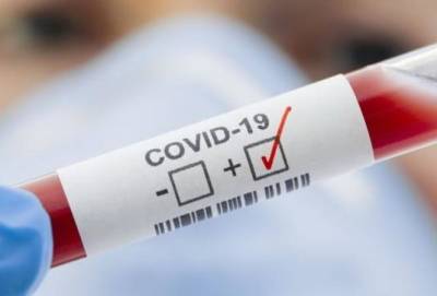 В Украине зафиксировано 285 новых случаев COVID-19 - vchaspik.ua - Украина