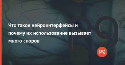 Илон Маск - Что такое нейроинтерфейсы и почему их использование вызывает много споров - thepage.ua - Украина