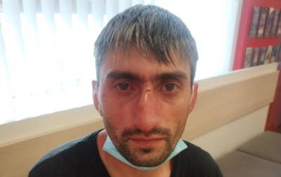 В Киеве избили антимайдановца "Топаза" - korrespondent.net - Украина - Киев - Нападение