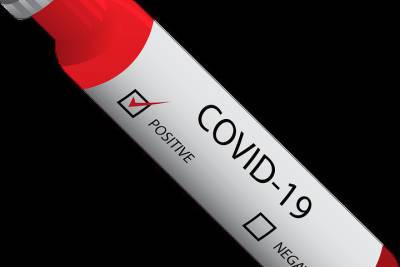 Роберт Кох - 4 июня: в Германии 3.165 новых случаев заражения Covid-19, умерших за сутки - 86 - mknews.de