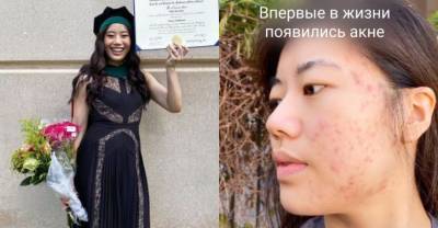 Студентка меда показала, что красный диплом сделал с её внешностью, и разница оказалась пугающей - reendex.ru