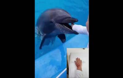 В Одессе дельфин укусил мальчика - korrespondent.net - Одесса