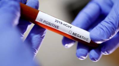 Ученые выяснили, почему COVID-19 иногда протекает бессимптомно - ru.slovoidilo.ua - Англия - Эмираты