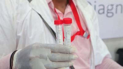 Джонс Хопкинс - В мире число выявленных случаев заражения коронавирусом превысило 173,5 миллиона человек - 1tv.ru
