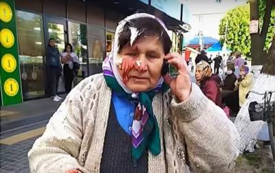 На Ровенщине бизнесвумен разбила пенсионерке голову за торговлю на улице - korrespondent.net - Ровенская обл.