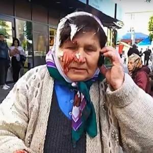 В Ровенской области пенсионерке разбили голову банкой сметаны. Видео - reporter-ua.com - Ровенская обл.