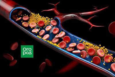 6 признаков того, что у вас атеросклероз - skuke.net