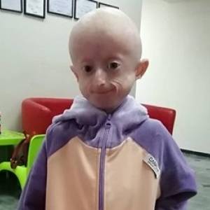 В Виннице скончалась 10-летняя девочка с синдромом раннего старения. Фото - reporter-ua.com - Украина