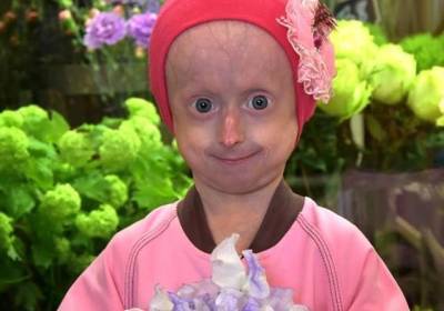 10-летняя девочка из Винницы умерла от старости (фото) - sharij.net - Украина - Киев