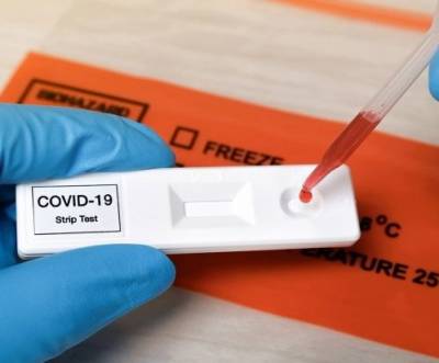 Курьез: школьники из Великобритании подделывали экспресс-тесты на Covid-19 с помощью Coca-Cola. ФОТО - enovosty.com - Англия