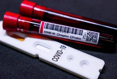 В Украине за сутки зафиксировано 290 новых случаев COVID-19 - vchaspik.ua - Украина