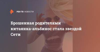 Брошенная родителями китаянка-альбинос стала звездой Сети - ren.tv - Китай - Голландия