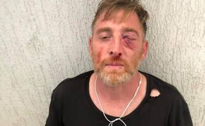 В Грузии найден мертвым телеоператор, которого избили на марше ЛГБТ - znak.com - Грузия