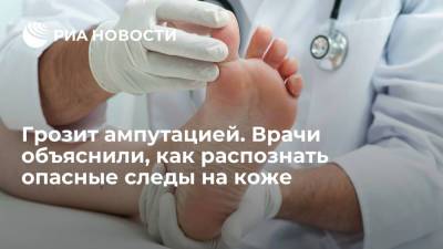 Daily Express: запущенный диабет второго типа может привести к ампутации - ria.ru - Москва - США