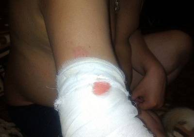 В Рязани домашняя собака покусала на улице мужчину - ya62.ru - Рязань - Нападение