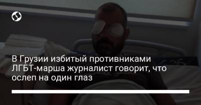 В Грузии избитый противниками ЛГБТ-марша журналист говорит, что ослеп на один глаз - liga.net - Украина - Грузия