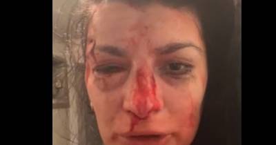 В Днепре двое мужчин жестоко избили общественную активистку (ВИДЕО 18+) - dsnews.ua - Украина - Днепр