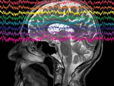 Стивен Хокинг - Исследователи прочитали фразы по мозговым волнам парализованного человека - polit.ru
