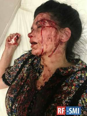 В Днепре избили известную активистку Наталью Эшонкулову - rf-smi.ru