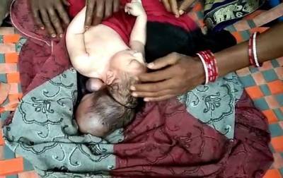 В Индии родился трехглавый ребенок - real-vin.com - Украина - India - штат Уттар-Прадеш