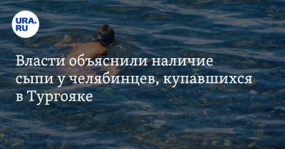 Виталий Безруков - Власти объяснили наличие сыпи у челябинцев, купавшихся в Тургояке - ura.news - Челябинская обл. - Экология