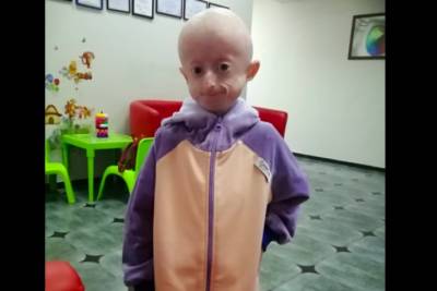 В Виннице умерла юная художница – девочка с редчайшим синдромом преждевременного старения - rupor.info - Киев
