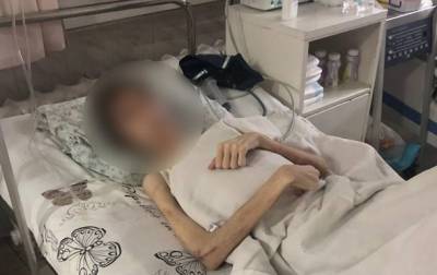Житель Одессы морил сына голодом - korrespondent.net - Украина - Одесса - Одесская обл.