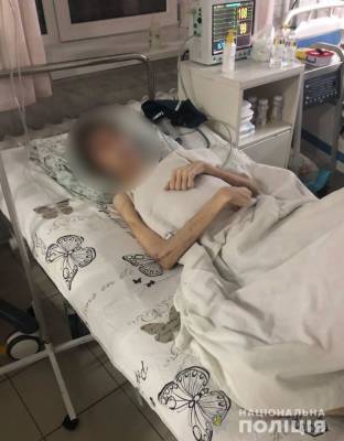«Лечил, но духовно»: в Одессе отец морил голодом 16-летнего сына - narodna-pravda.ua - Украина - Одесса - Одесская обл.