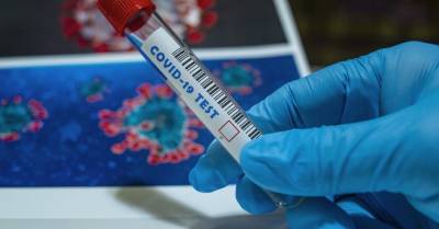 "Дельта" вытесняет "альфу". Индийский штамм Covid-19 — причина уже 79% случаев заболевания Covid-19 в Латвии - rus.delfi.lv - Латвия
