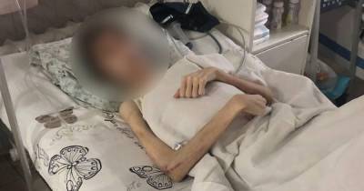 30 кг веса при росте 180 см: в Одессе отец "лечил" подростка от "нечистых бесов" (фото, видео) - focus.ua - Украина - Одесса